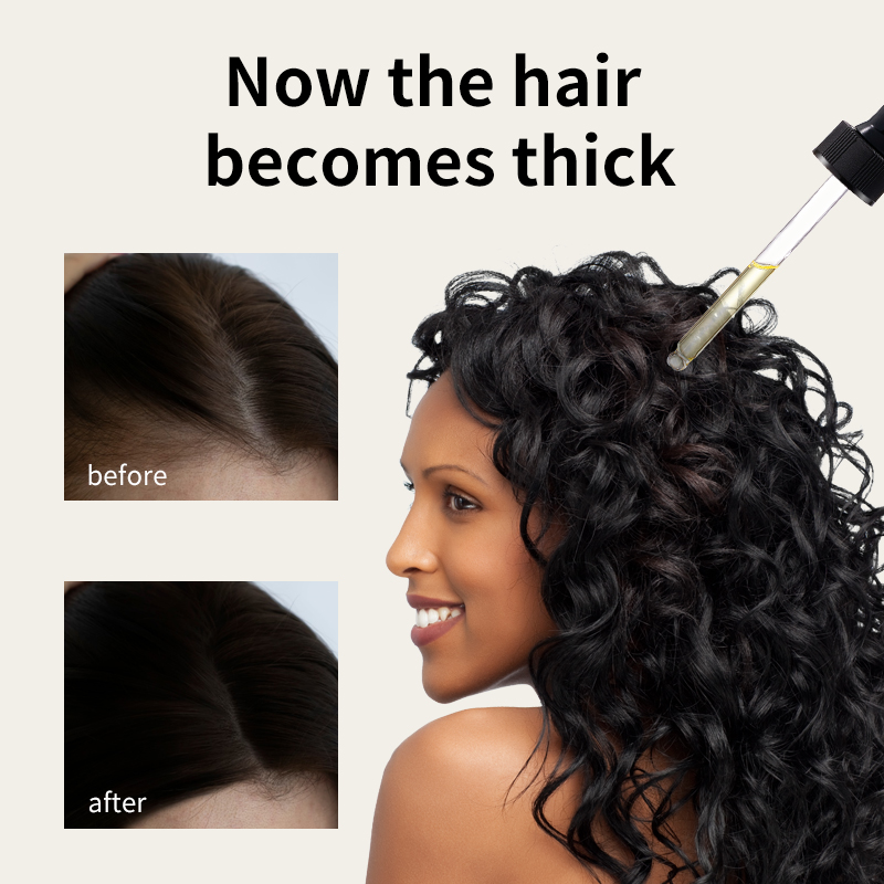 Óleo de crescimento capilar Syulli | Óleo Antiqueda de Alecrim e Gengibre | Estimular folículos