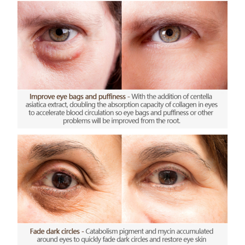 Creme de olhos antirrugas personalizado com aplicador (2) 